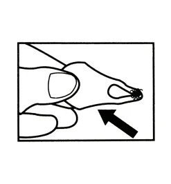 Tick Key Tick Remover